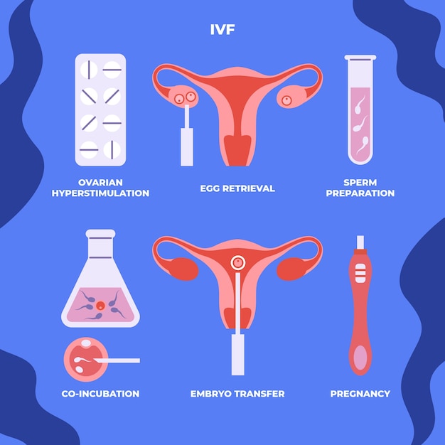 Hand drawn flat design ivf infographic