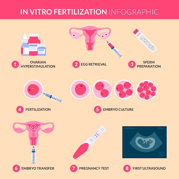 Ручной обращается плоский дизайн ivf инфографика