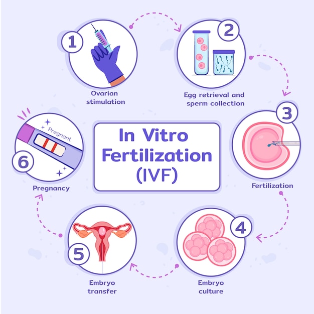 Ручной обращается плоский дизайн ivf инфографика