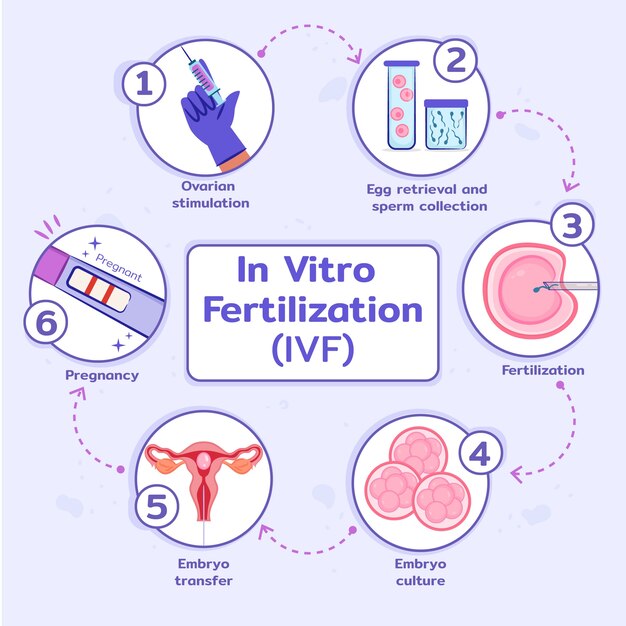 손으로 그린된 평면 디자인 ivf infographic