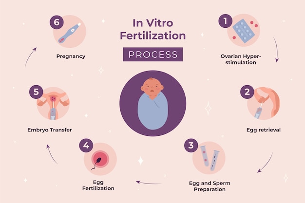 손으로 그린된 평면 디자인 ivf infographic