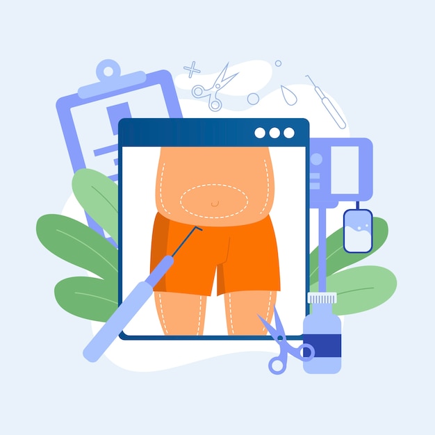 Hand drawn flat design liposuction illustration