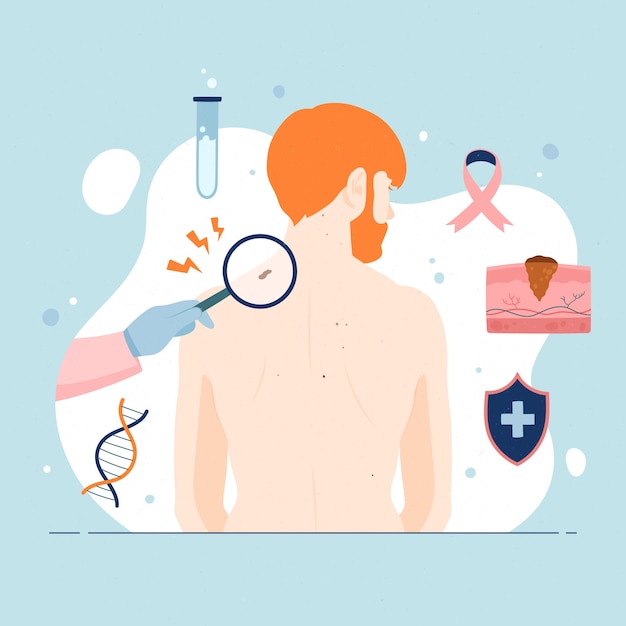 Free vector hand drawn flat design melanoma illustration