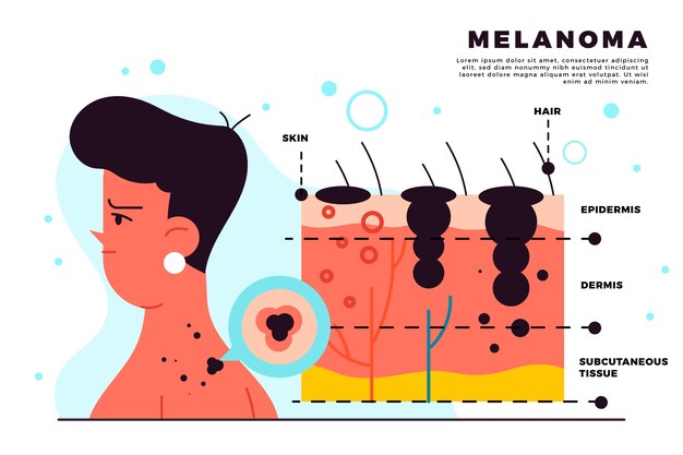 Инфографика меланомы ручной работы с плоским дизайном