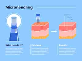 Vettore gratuito infografica di micro needling di design piatto disegnata a mano