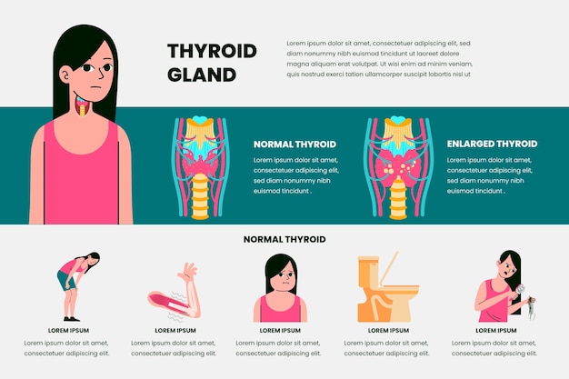 Vettore gratuito infografica della tiroide di design piatto disegnato a mano