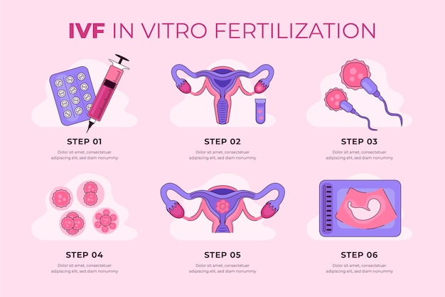 Hand drawn ivf infographic