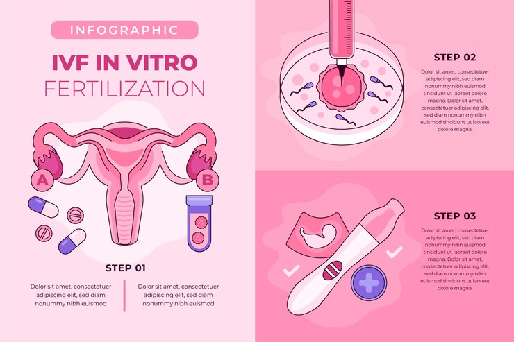Free Vector hand drawn ivf infographic