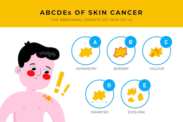 Free vector hand drawn melanoma infographic