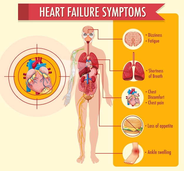 Free vector heart failure symptoms information infographic