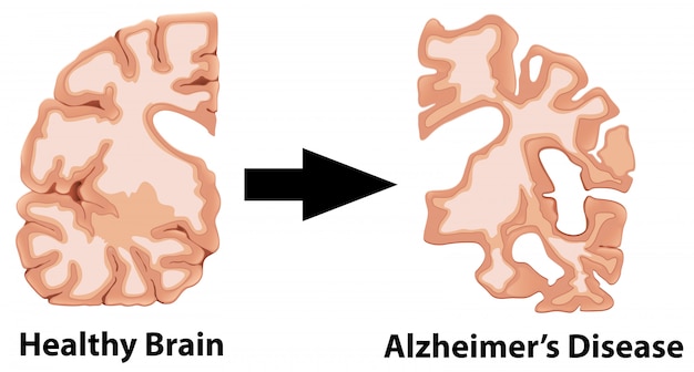 Un'anatomia umana del cervello