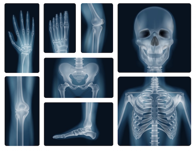 Человеческие кости реалистичные рентгеновские снимки