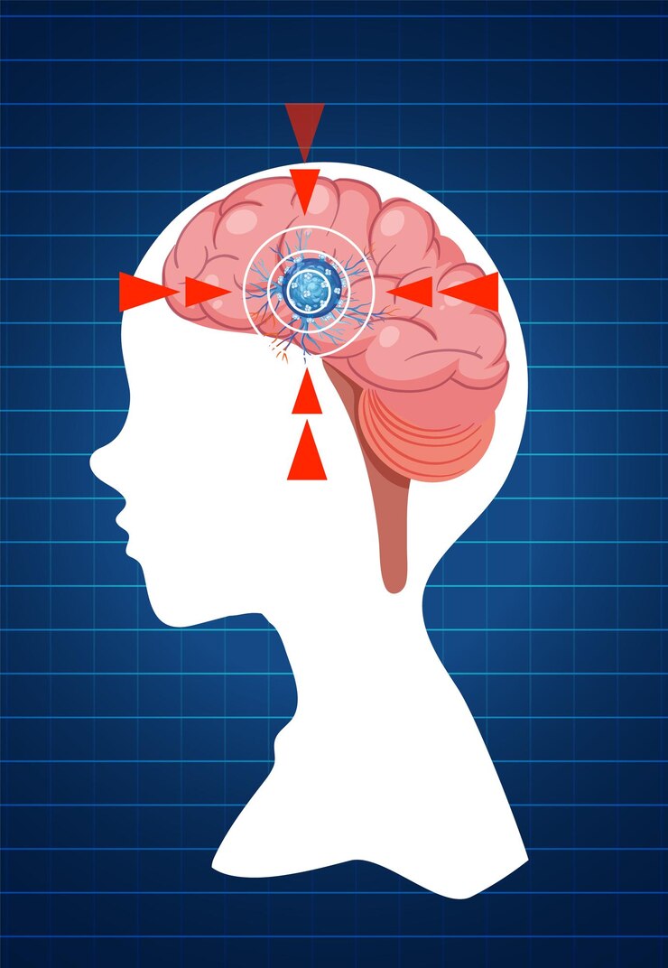 Free Vector human brain with cancer cell illustration