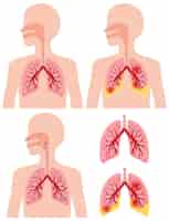 Vettore gratuito collezione di icone dei polmoni umani