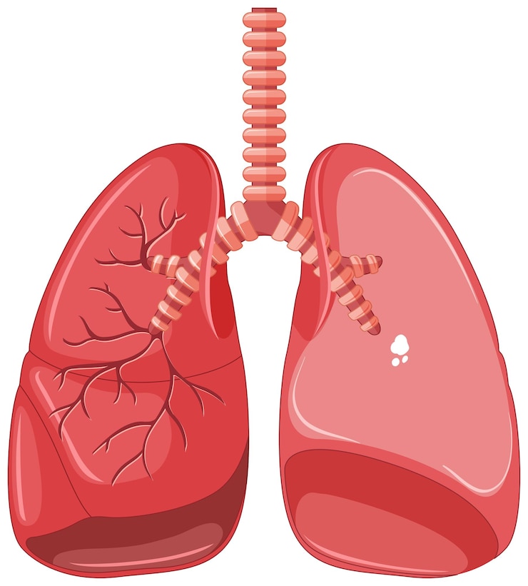मुफ़्त वेक्टर human lungs with tuberculosis