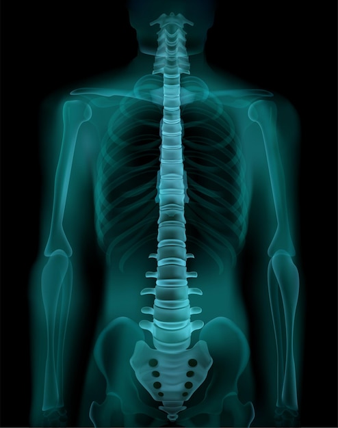 인간의 척추 및 골반 현실적인 X- 선 CT 방사선 촬영 형광 투시 의료 선별 검사 이미지