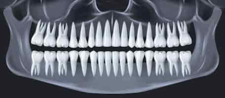 Vettore gratuito concetto di anatomia dentale dei denti umani con immagine vettoriale realistica del colpo a raggi x della mandibola