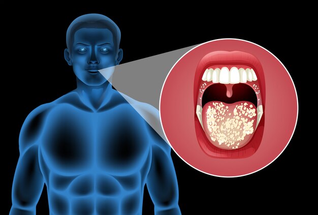 A Human Vector of Mouth