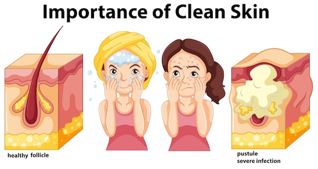 Importance of clean skin concept