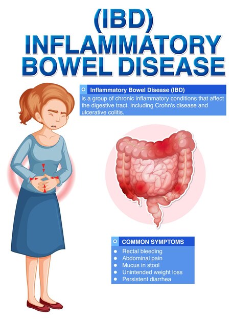 inflammatory bowel disease ibd infographic