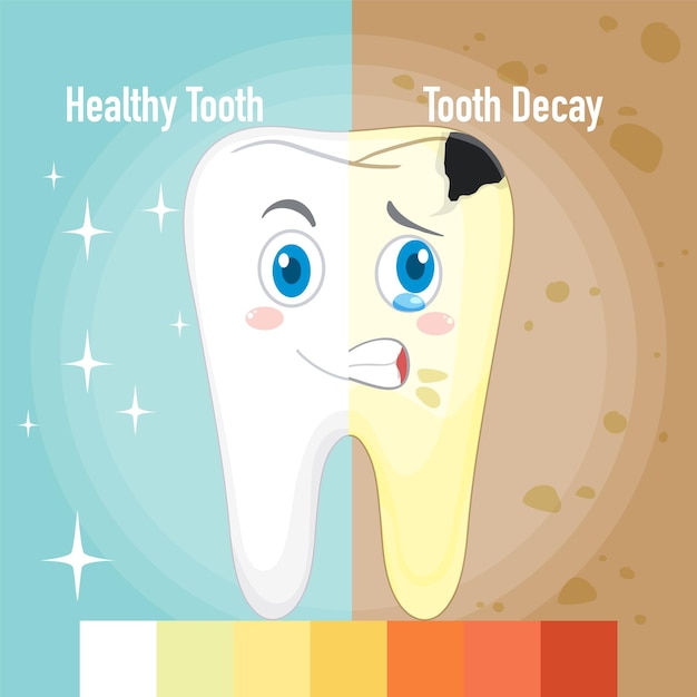 健康な歯と虫歯のインフォグラフィック