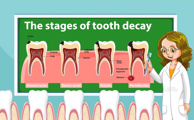 Free vector infographic of human in the stages of tooth decay