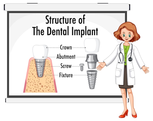 Free vector infographic of human in structure of the dental implant