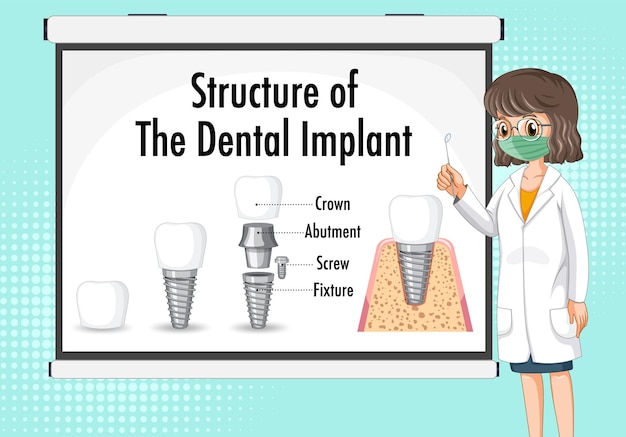 Infographic of human in structure of the dental implant