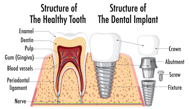 Инфографика человека в структуре здорового зуба