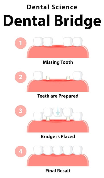 Бесплатное векторное изображение Инфографика человека в зубном мосту