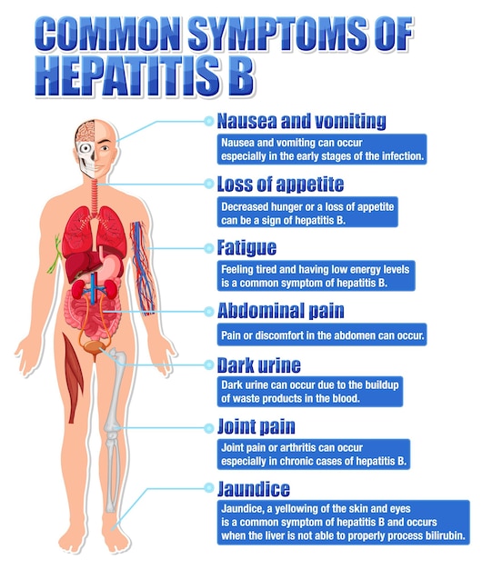 Free vector informative poster of common symptoms hepatitis b