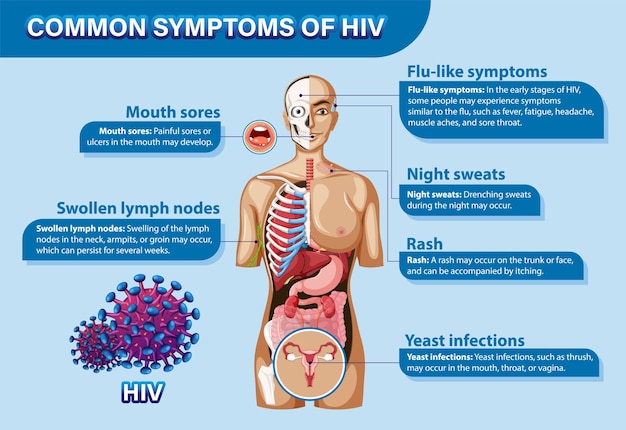 Free vector informative poster of common symptoms of hiv