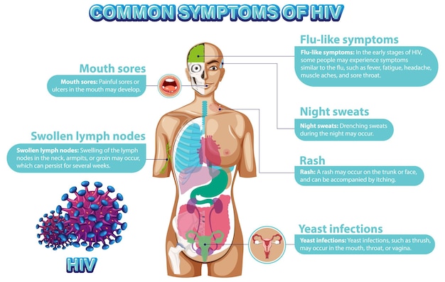 Free vector informative poster of common symptoms of hiv