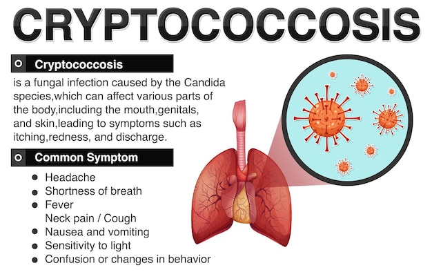 Free vector informative poster of cryptococcosis