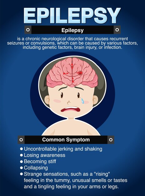 Poster informativo sull'epilessia