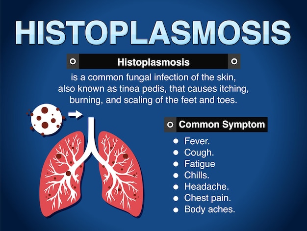 Free vector informative poster of histoplasmosis