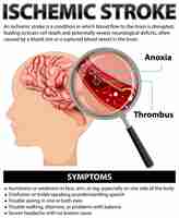 Free vector informative poster of ischemic stroke