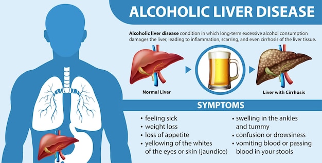 Информационный плакат об алкогольной болезни печени цирроз печени