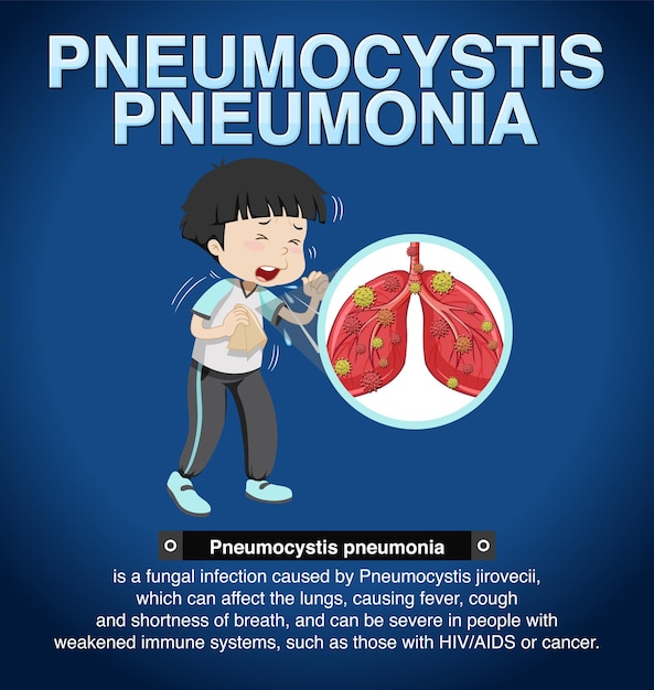 Бесплатное векторное изображение Информационный плакат pneumocystis pneumonia