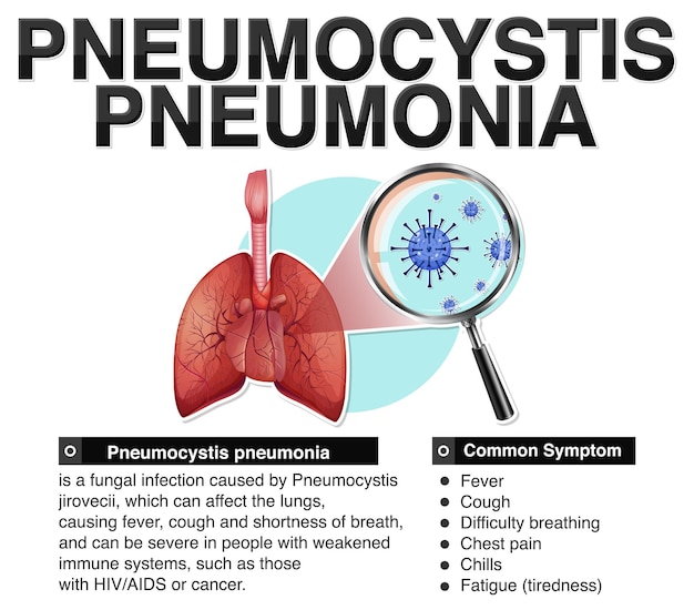 Vettore gratuito poster informativo sulla polmonite da pneumocystis