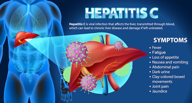 Информативные симптомы гепатита С