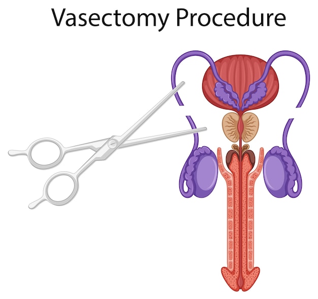 Free vector inside the male reproductive system