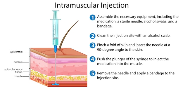 Intramuscular injection with explanation