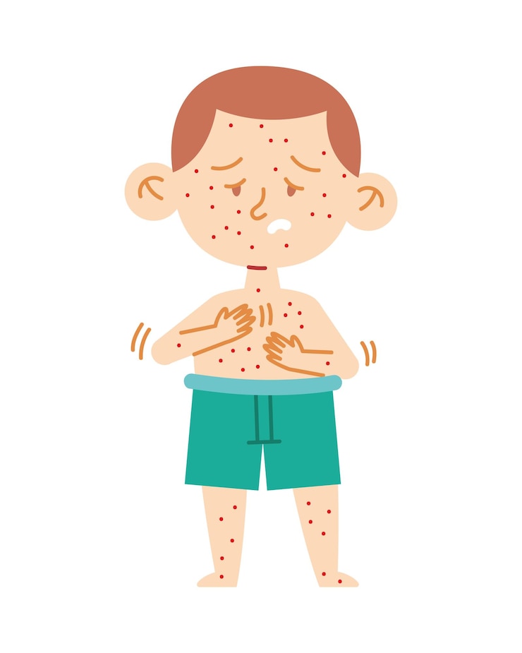 Free Vector kawasaki disease illustration of a sick kid