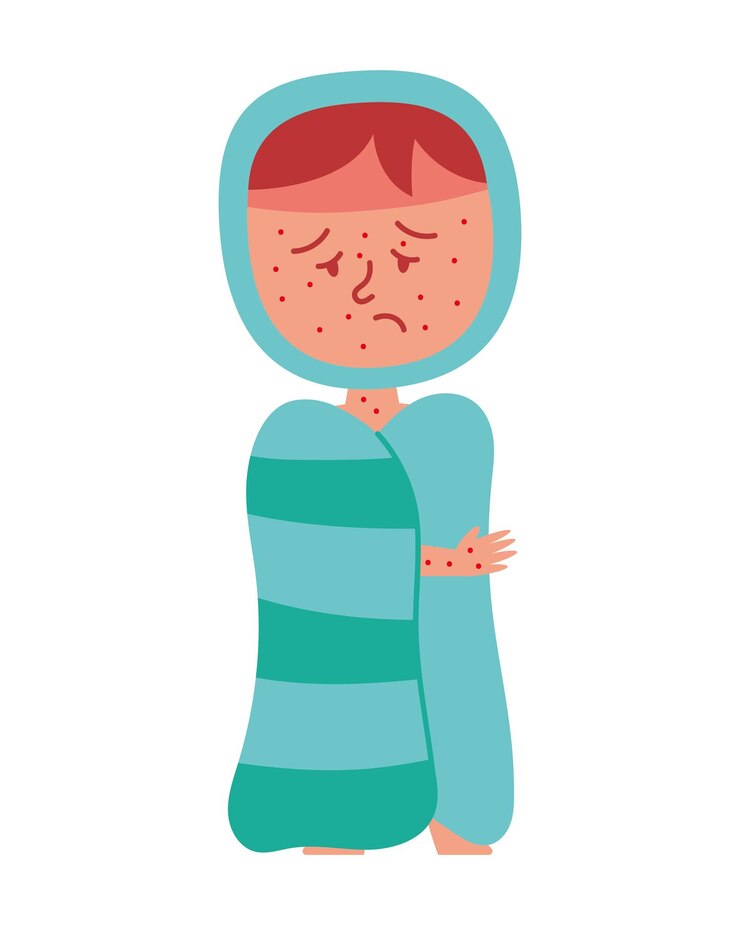 Free Vector kawasaki disease on a kid