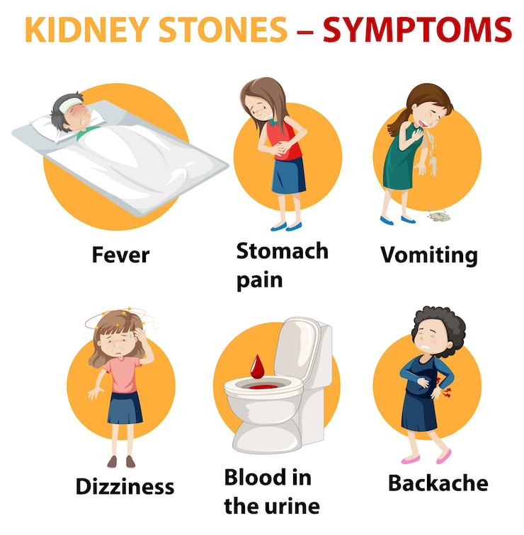 Free Vector kidney stones symptoms cartoon style infographic