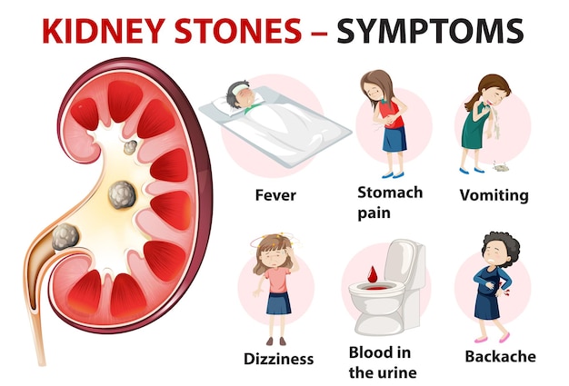 Kidney stones symptoms cartoon style infographic