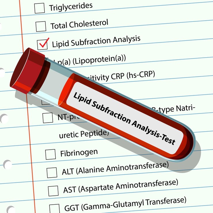 Free Vector lipid subfraction analysis test illustration