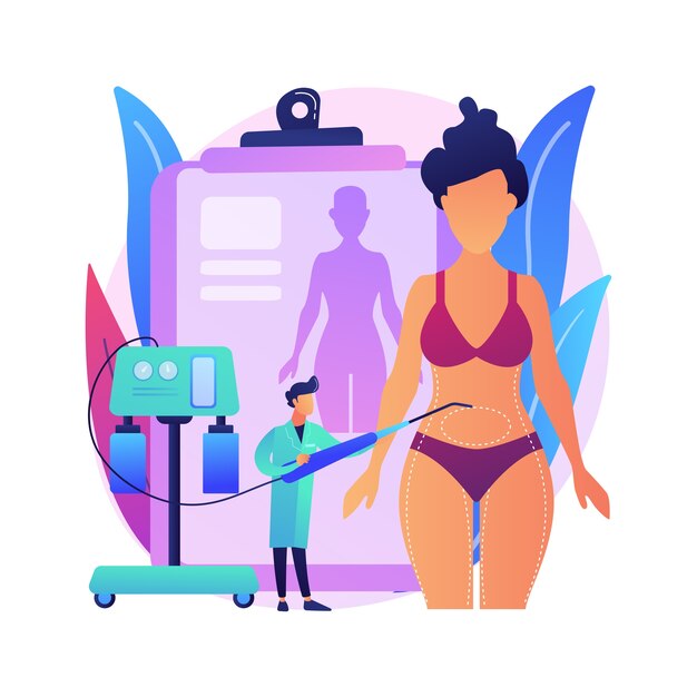 liposuction abstract concept   illustration. lipo procedure, vacuum out fat removal plastic surgery, body contouring, beauty standard, weight loss, liposuction alternatives