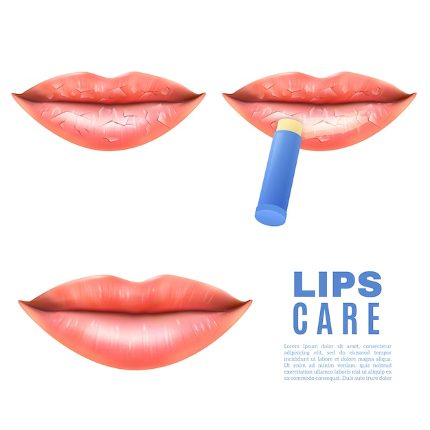 Free vector lips care and protection realistic poster